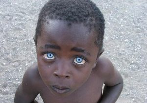 ojos-nino-africa--644x450